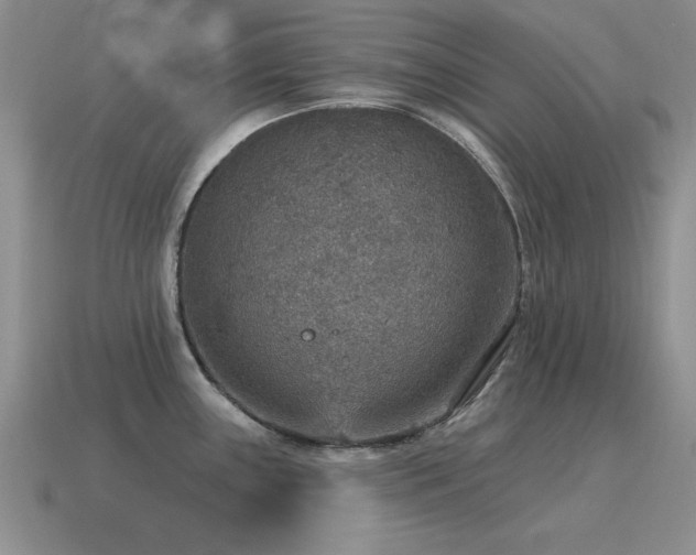 X0000115611243200911101420
