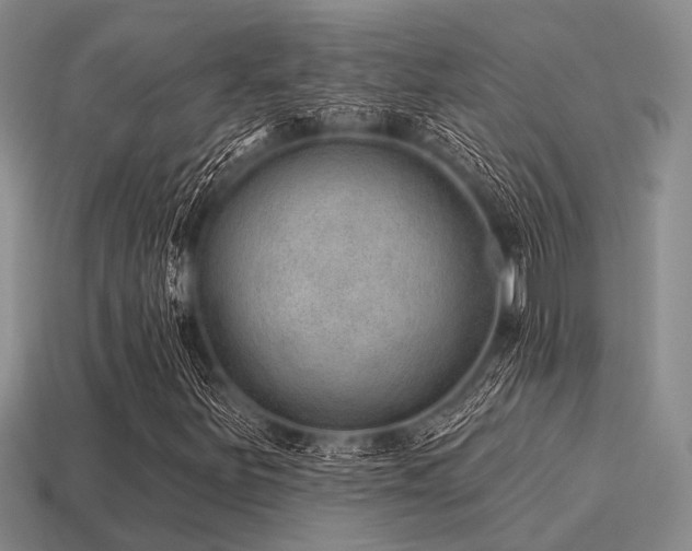 X0000115611251200911101420