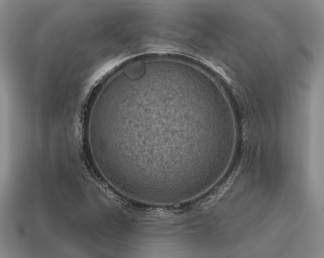 X0000115611311200911101418