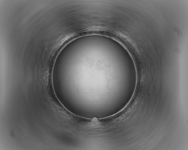 X0000115611313200911101418