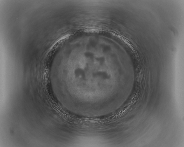 X0000115611351200911101418
