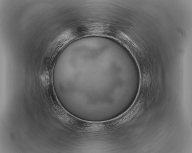 X0000115611353200911101418