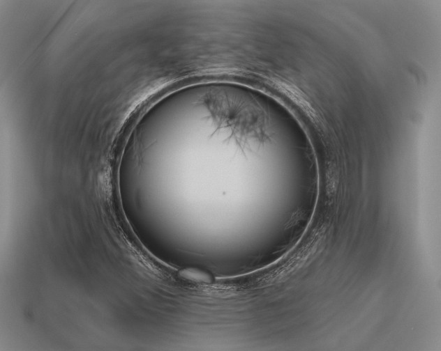 X0000115611356200911101418