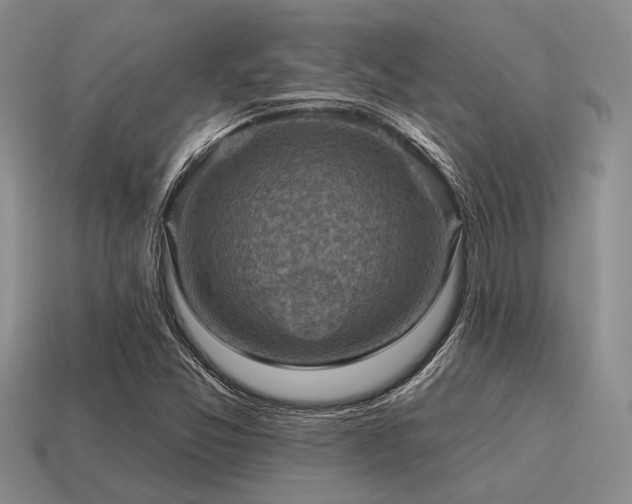 X0000115611357200911101418