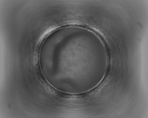 X0000115611359200911101418
