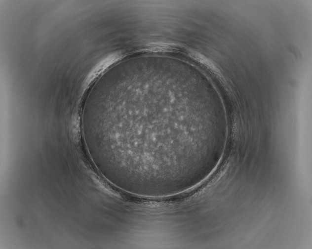 X0000115611362200911101418