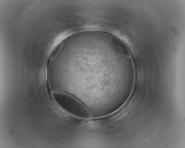 X0000115611365200911101418