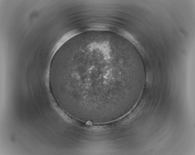 X0000115611378200911101418