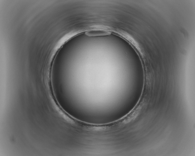 X0000115611381200911101418