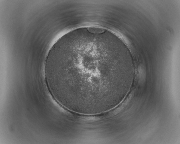 X0000115611382200911101418