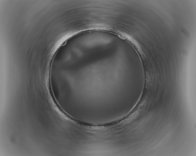X0000115611383200911101418
