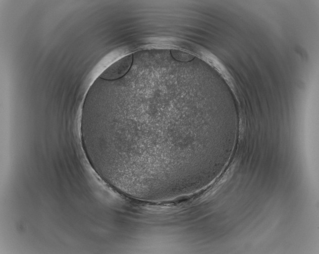 X0000115611386200911101418