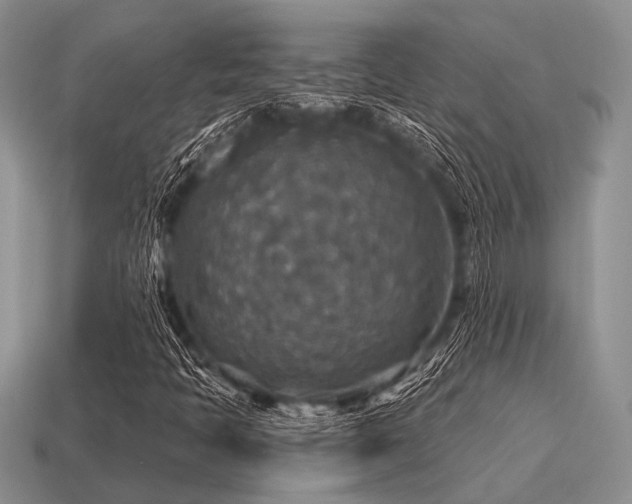 X0000115611397200911101417