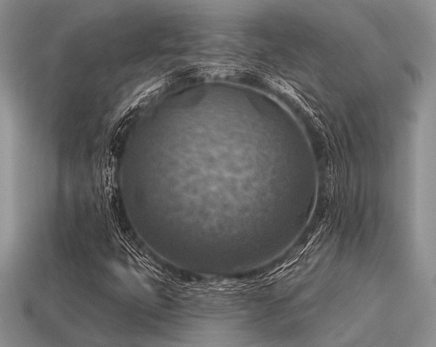 X0000115611399200911101417