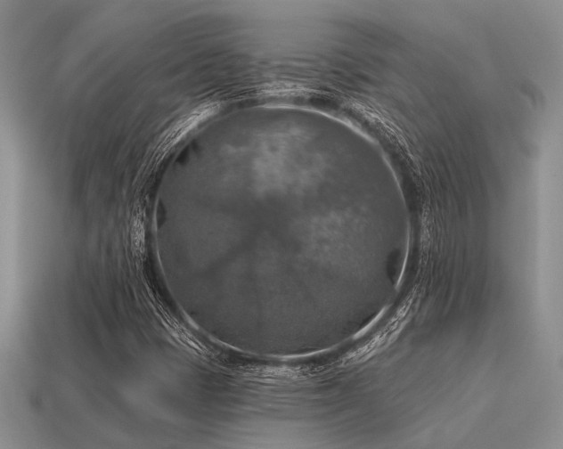 X0000115611401200911101417