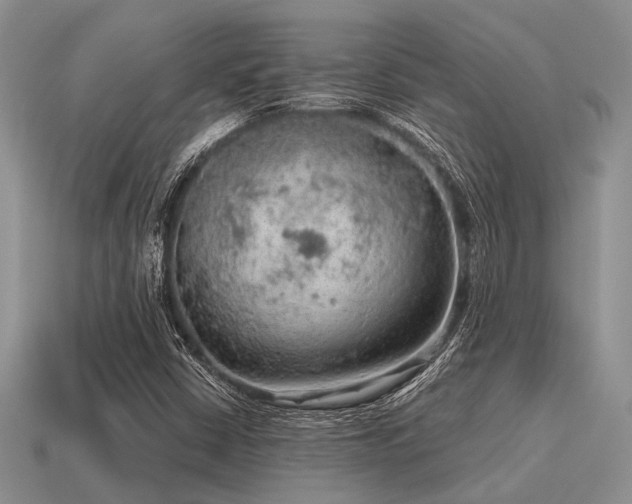 X0000115611402200911101417