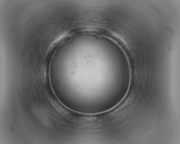 X0000115611403200911101417