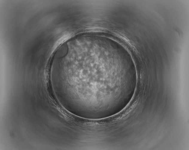 X0000115611405200911101417