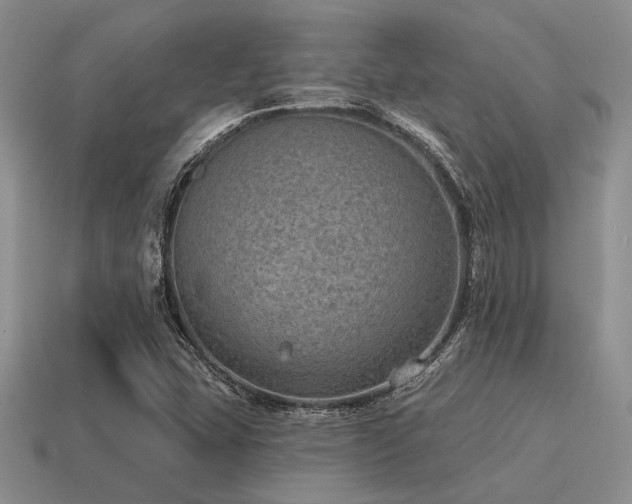X0000115611407200911101417
