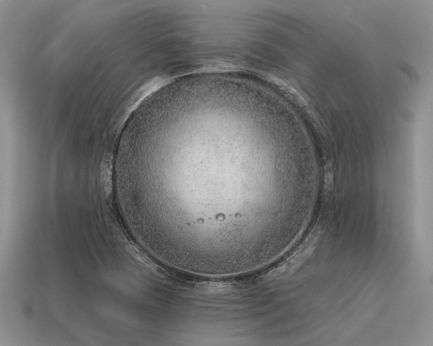 X0000115611409200911101417