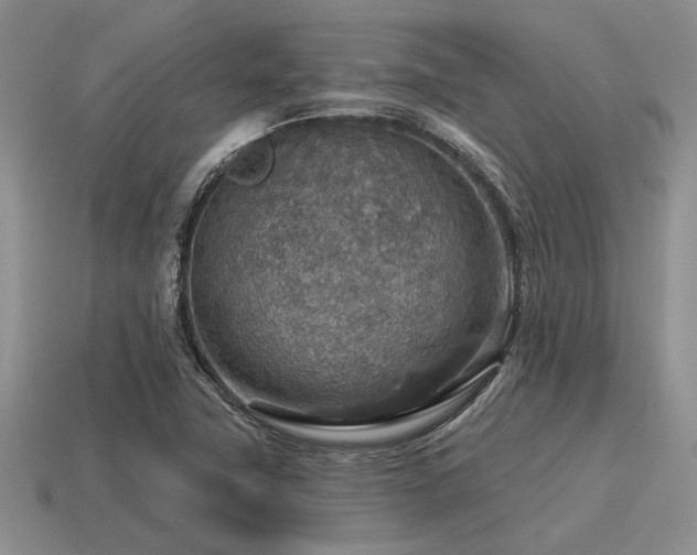 X0000115611411200911101417
