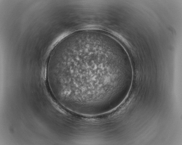 X0000115611413200911101417