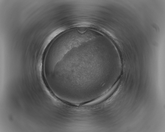 X0000115611418200911101417