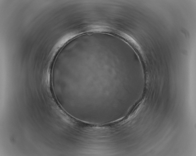 X0000115611419200911101417