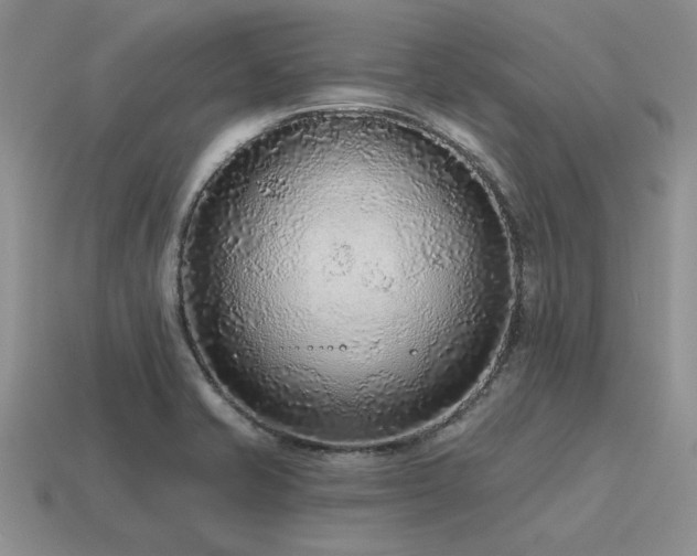X0000115611421200911101417
