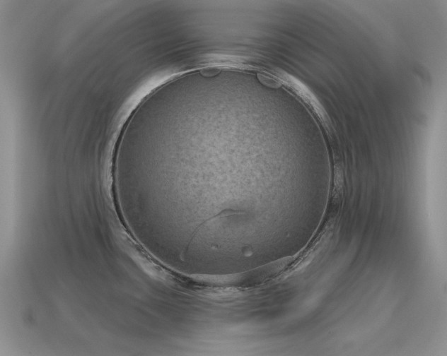 X0000115611435200911101418