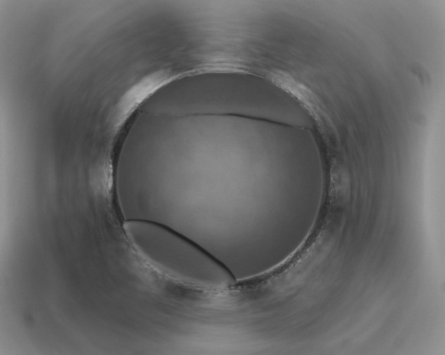 X0000115611461200911101417