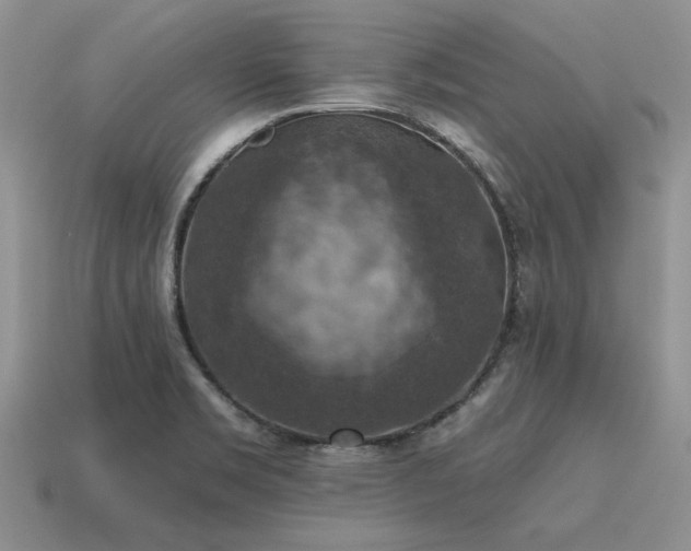 X0000115611469200911101417