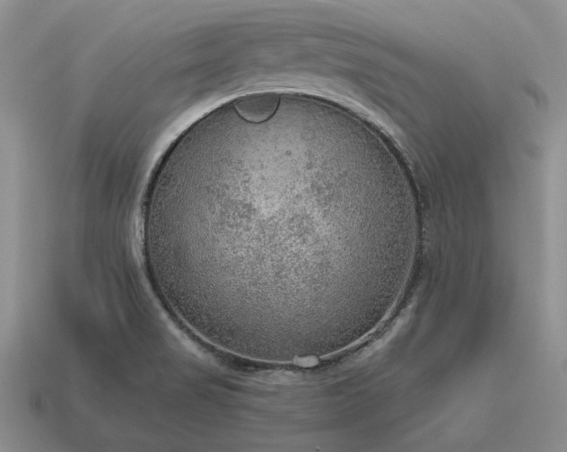 X0000115611517200911101416