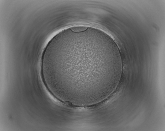 X0000115611523200911101416