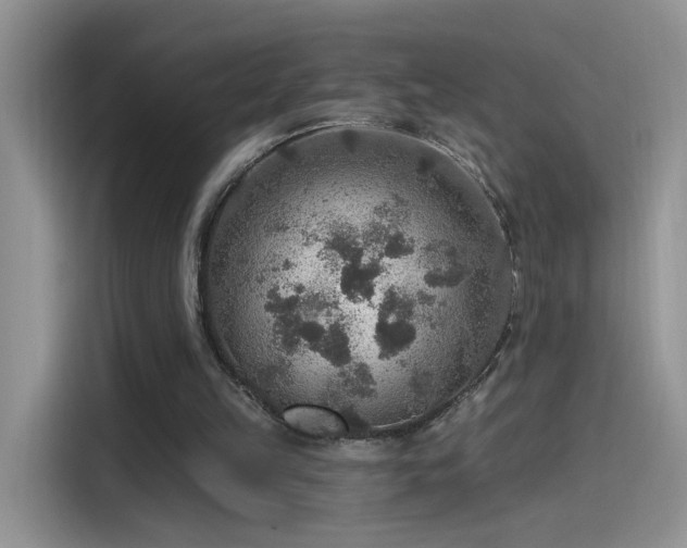 X0000115610149200911171155
