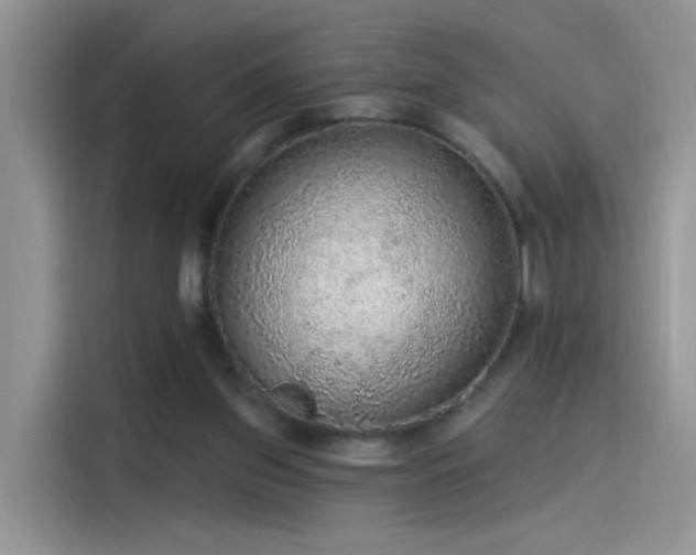 X0000115610157200911171155