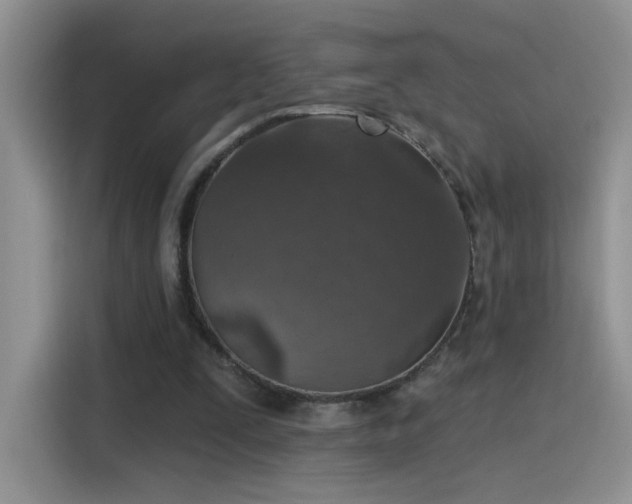 X0000115610295200911171154