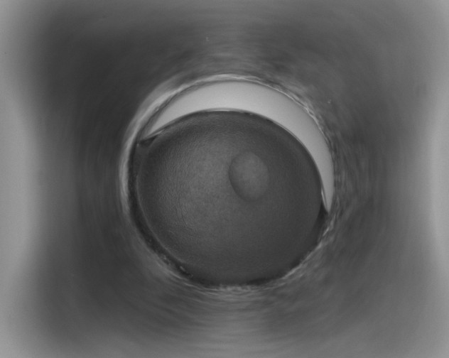 X0000115610296200911171154