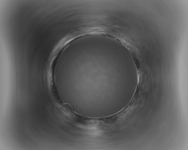 X0000115610339200911171152