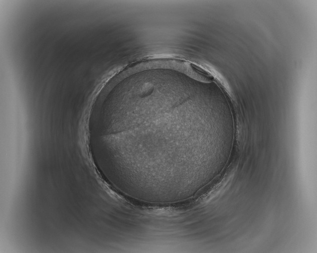 X0000115610385200911171152