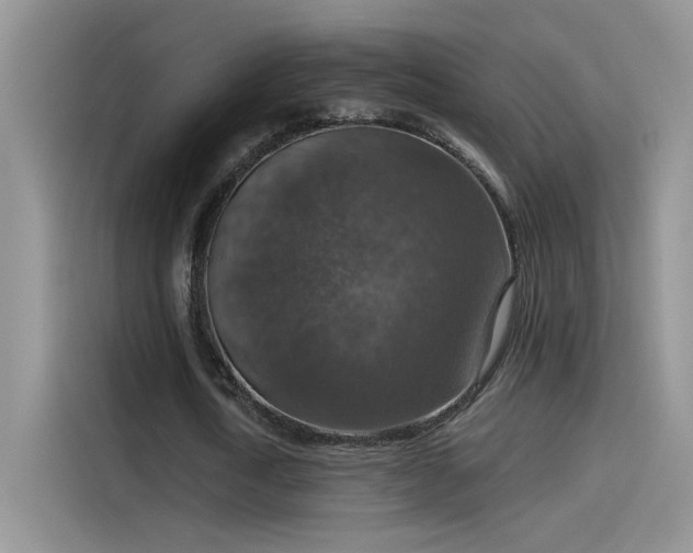 X0000115610722200911171147