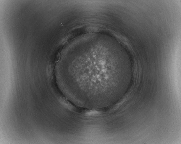 X0000115610759200911171148