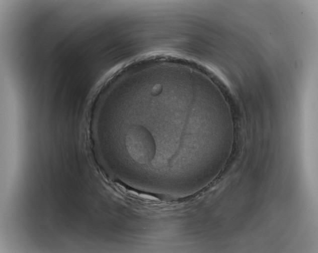X0000115610872200911171146