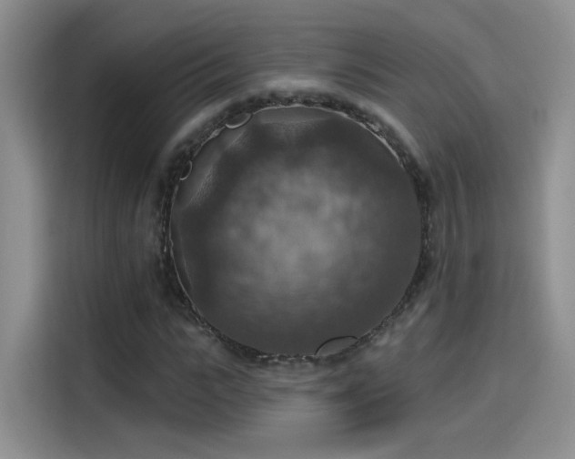 X0000115610919200911171145