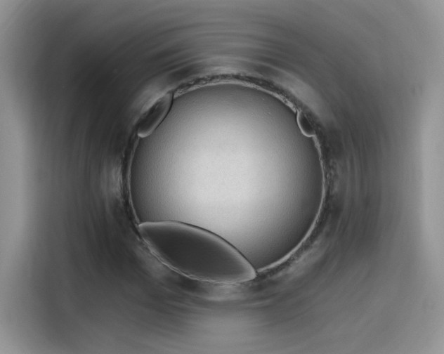 X0000115610969200911171145