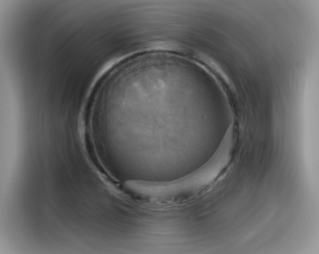 X0000115611024200911171144
