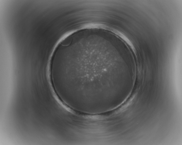 X0000115611045200911171144