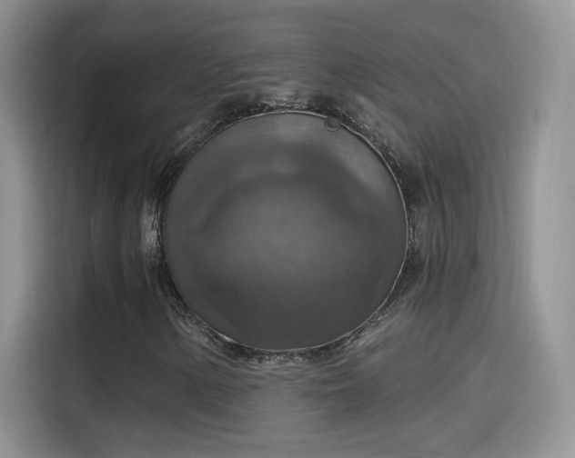 X0000115611154200911171142