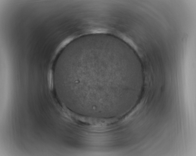 X0000115611171200911171142
