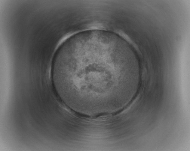 X0000115611222200911171141